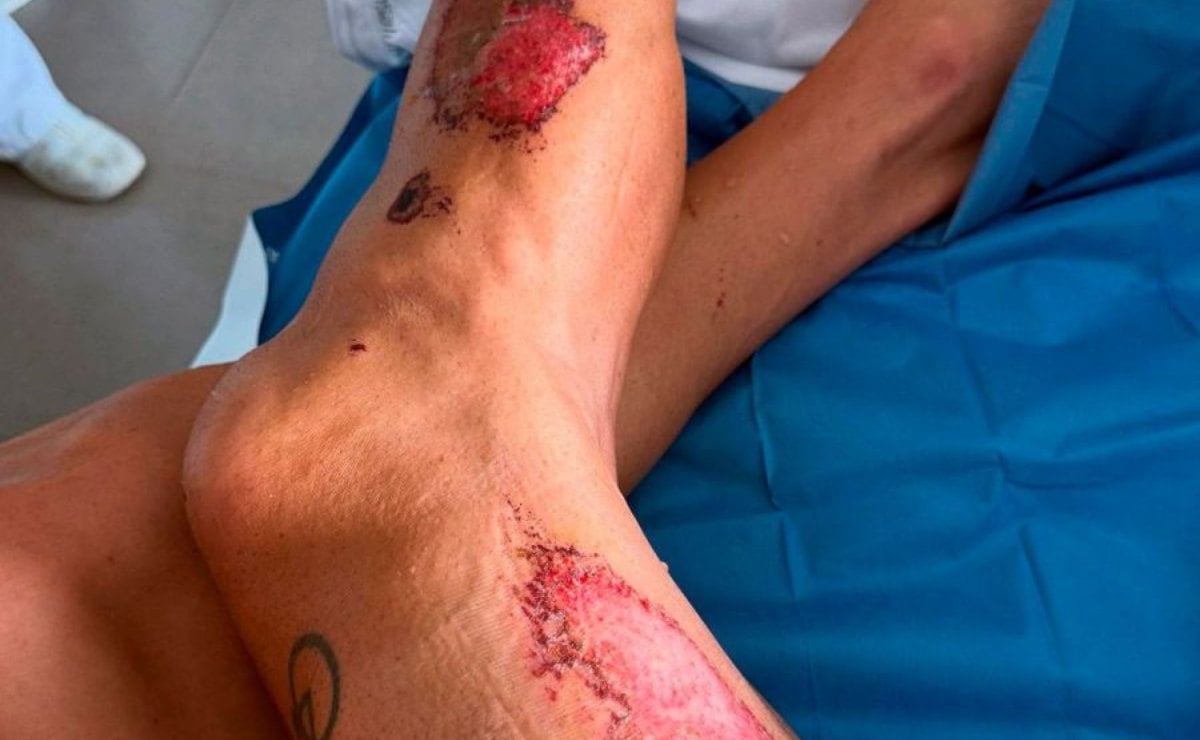 Piloto Honda accidente MotoGP